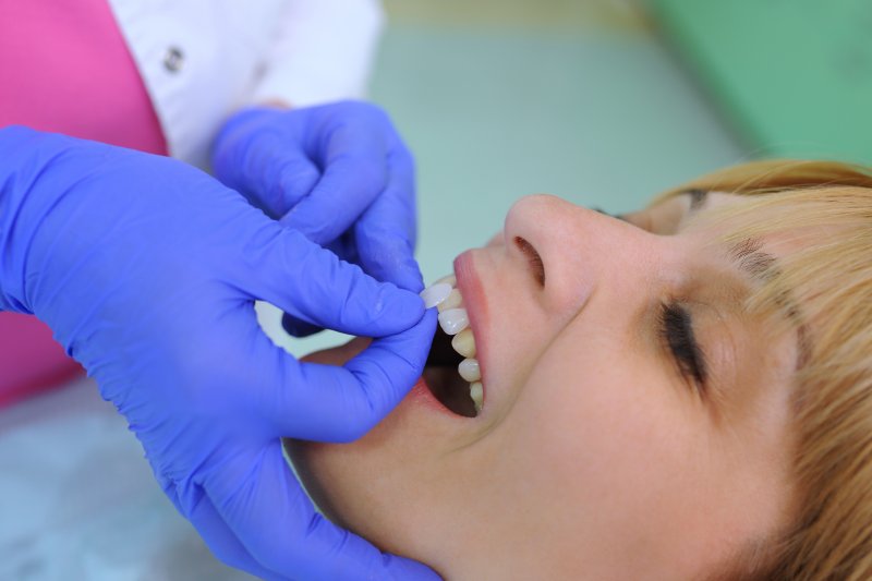 patient having veneers placed on their teeth